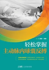 轻松掌握主动脉内球囊反搏