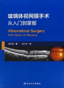 玻璃体视网膜手术 从入门到掌握