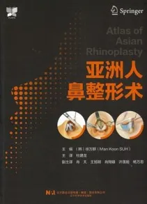 亚洲人鼻整形术