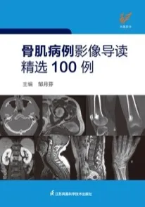 骨肌病例影像导读精选100例