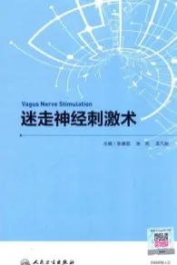 迷走神经刺激术