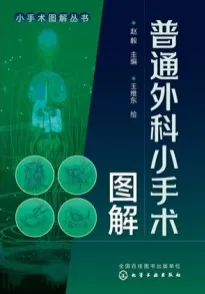 普通外科小手术图解