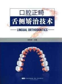 口腔正畸舌侧矫治技术
