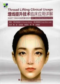 埋线提升技术临床应用详解