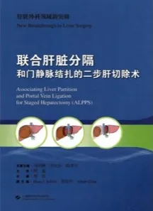 联合肝脏分隔和门静脉结扎的二步肝切除术