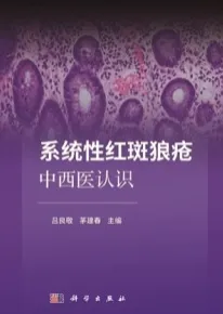 系统性红斑狼疮中西医认识