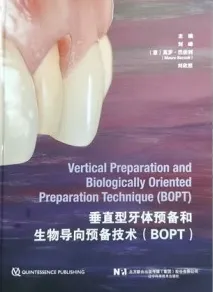 垂直型牙体预备和生物导向预备技术（BOPT）