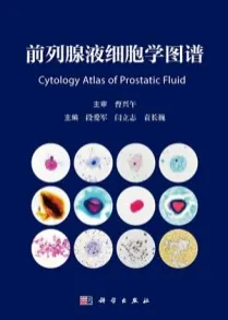 前列腺液细胞学图谱