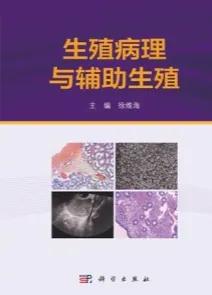 生殖病理与辅助生殖