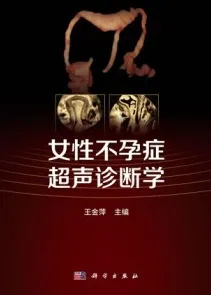 女性不孕症超声诊断学