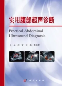 实用腹部超声诊断