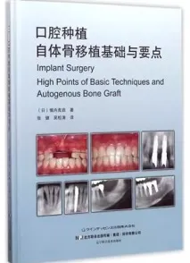 口腔种植自体骨移植基础与要点