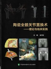 陶瓷全髋关节置换术理论与临床实践