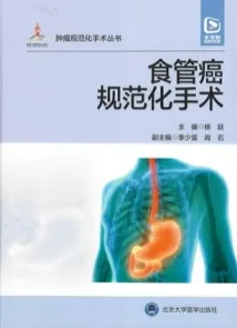 肿瘤规范化手术丛书 食管癌规范化手术