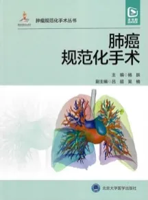 肿瘤规范化手术丛书 肺癌规范化手术