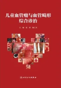 儿童血管瘤与血管畸形综合诊治