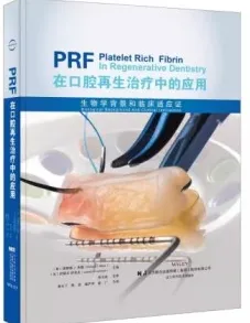 PRF在口腔再生治疗中的应用 生物学背景和临床适应证