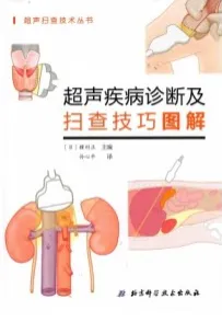 超声疾病诊断及扫查技巧图解
