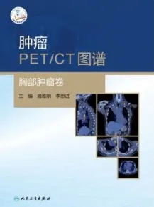 肿瘤PET CT图谱 胸部肿瘤卷