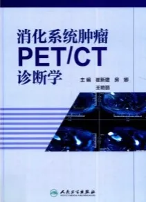 消化系统肿瘤PET CT诊断学