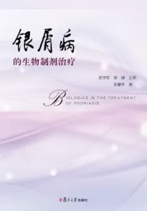 银屑病的生物制剂治疗