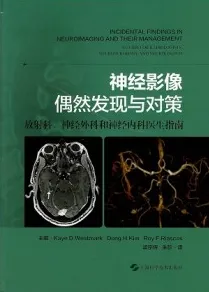 神经影像偶然发现与对策 放射科、神经外科和神经内科医生指南