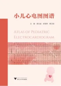 小儿心电图图谱