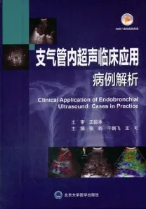 支气管内超声临床应用病例解析