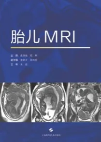 胎儿MRI