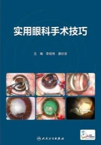 实用眼科手术技巧