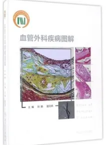 血管外科疾病图解