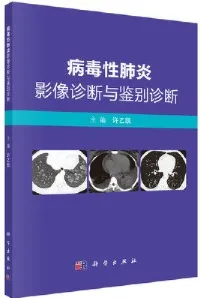 病毒性肺炎影像诊断与鉴别诊断