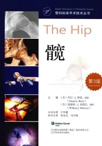 髋 第3版 骨科标准手术技术丛书