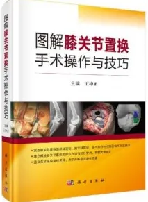 图解膝关节置换手术操作与技巧