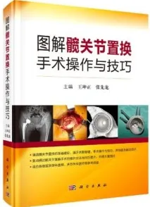 图解髋关节置换手术操作与技巧