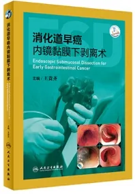 消化道早癌内镜黏膜下剥离术