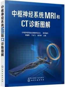 中枢神经系统MRI和CT诊断图解