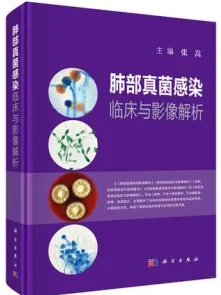 肺部真菌感染临床与影像解析