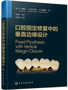 口腔固定修复中的垂直边缘设计