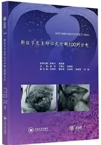 肺结节交互印证式诊断100例分析