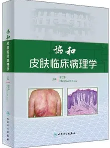 协和皮肤临床病理学