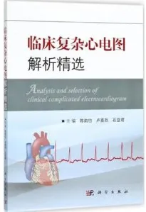 临床复杂心电图解析精选