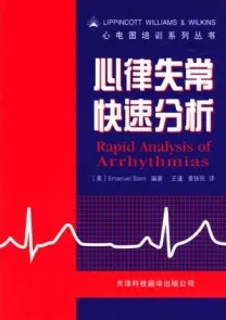 心律失常快速分析