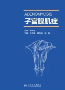 子宫腺肌症