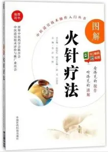图解火针疗法