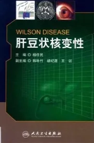 肝豆状核变性