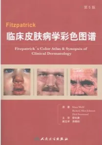 Fitzpatrick临床皮肤病学彩色图谱 第5版
