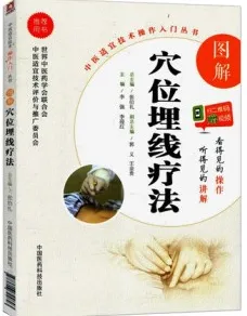 图解穴位埋线疗法