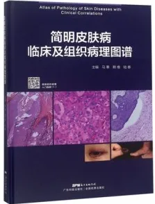 简明皮肤病临床及组织病理图谱