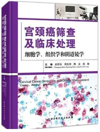 宫颈癌筛查及临床处理 细胞学、组织学和阴道镜学
